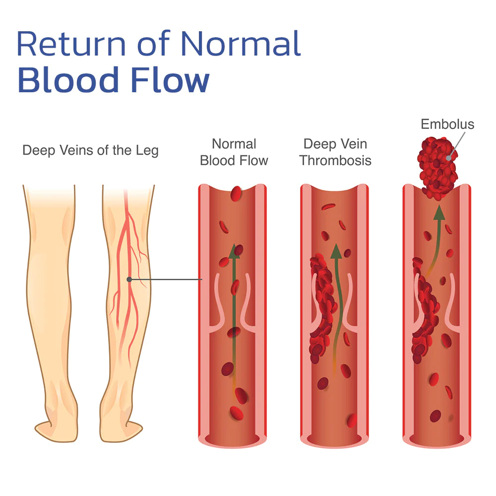 Serenithy™ EMS Foot Massager